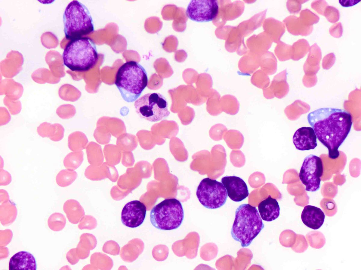 Bone marrow smear 400x_2